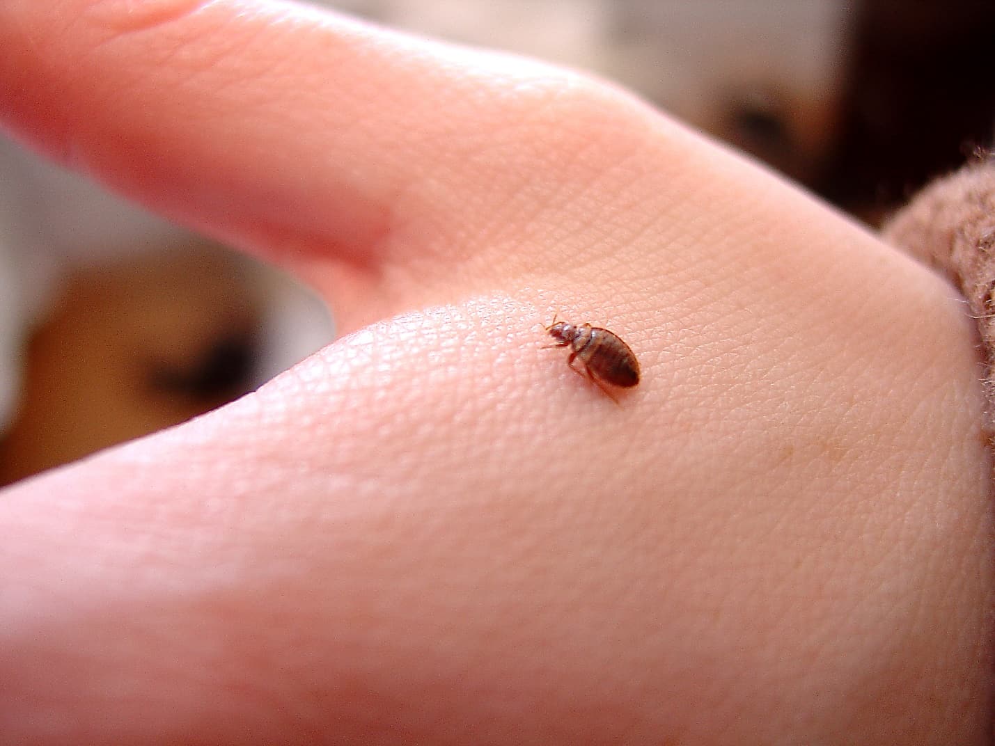beg bug on the hand